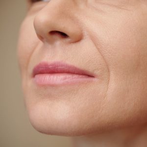 Tratamiento surco nasogeniano