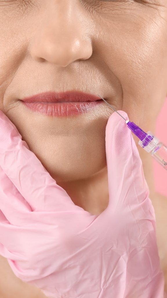 Tratamiento surco nasogeniano en Getxo